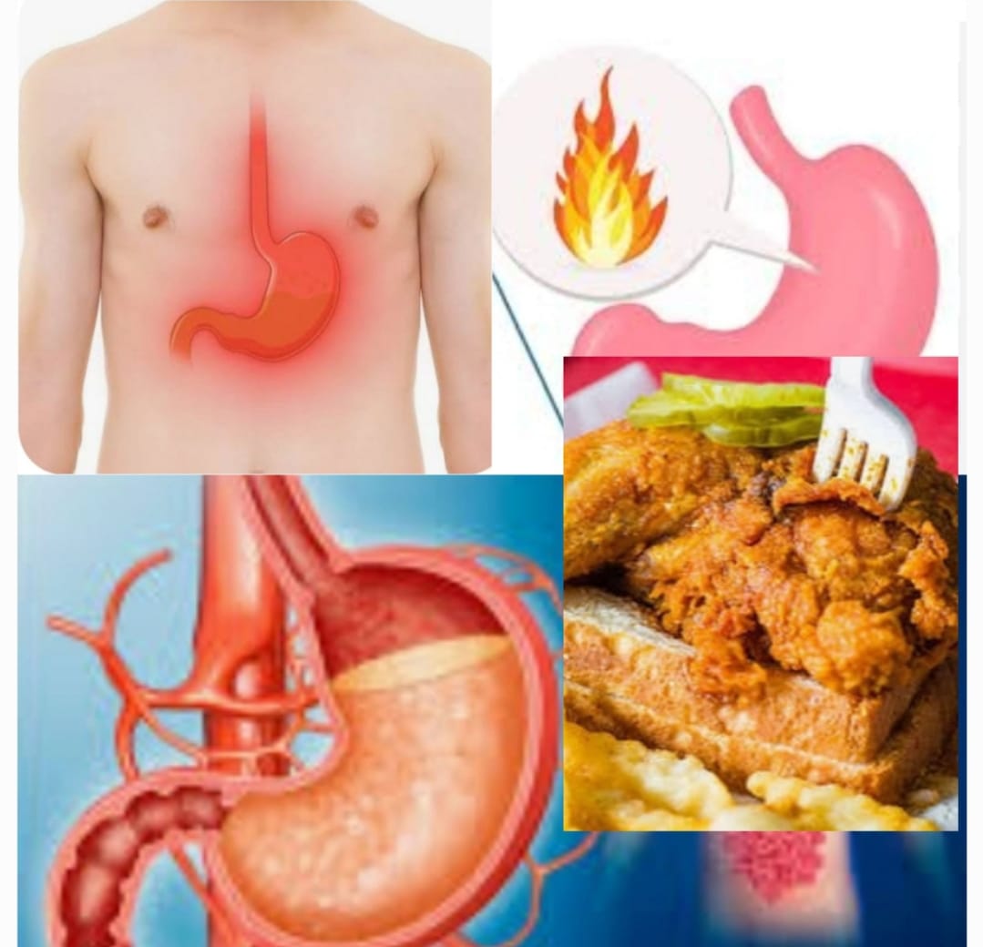 Suffering from Acidity or bloating?… Don’t worry,10 Easy Home Remedies for Acidity That Actually Work